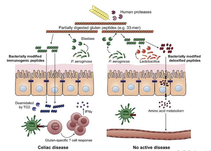 Digestión del gluten y microbiota intestinal